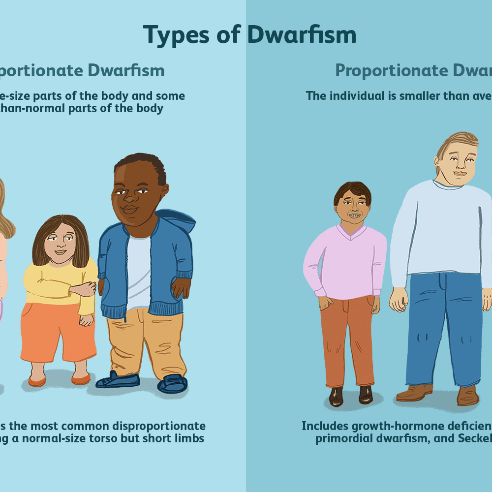 What are the main types of dwarfism?