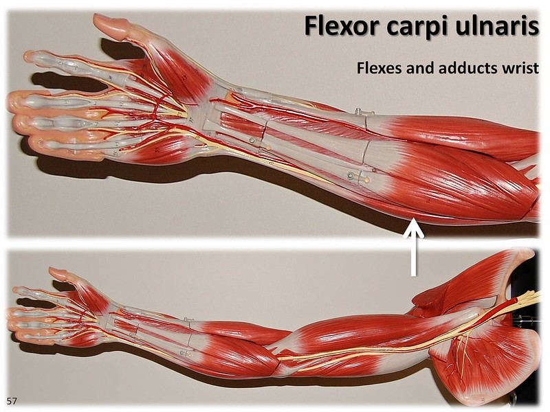 What is the difference between flexors and extensors?