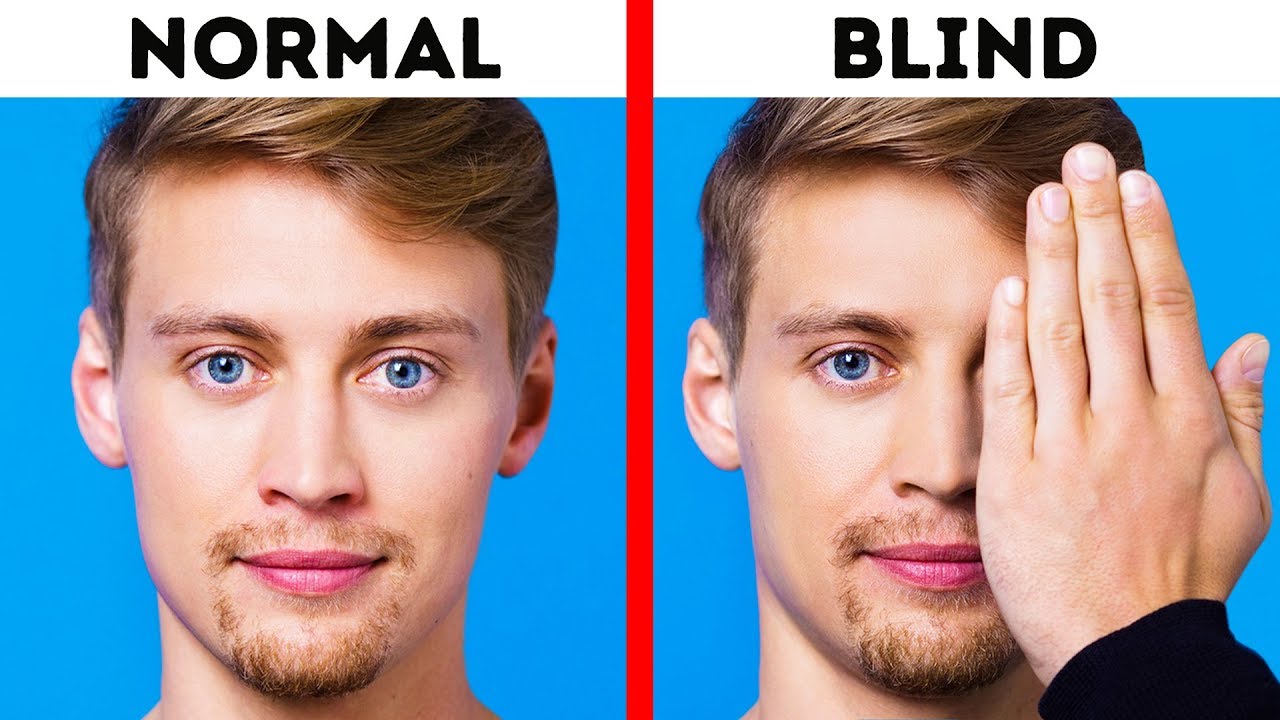 Can people be born completely blind?