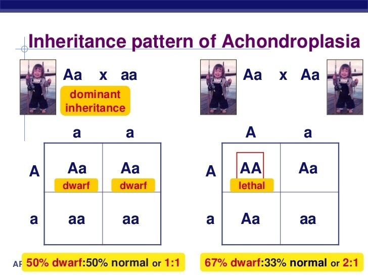 How do you calculate the percentage of dwarfs in the world?