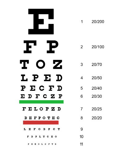 How do you know if you are legally blind?