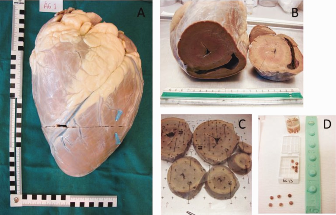 How thick is a giraffe's left ventricle?