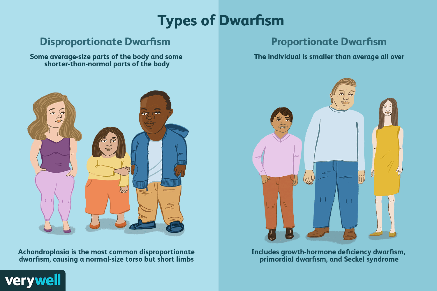 What are the types and causes of dwarfism?