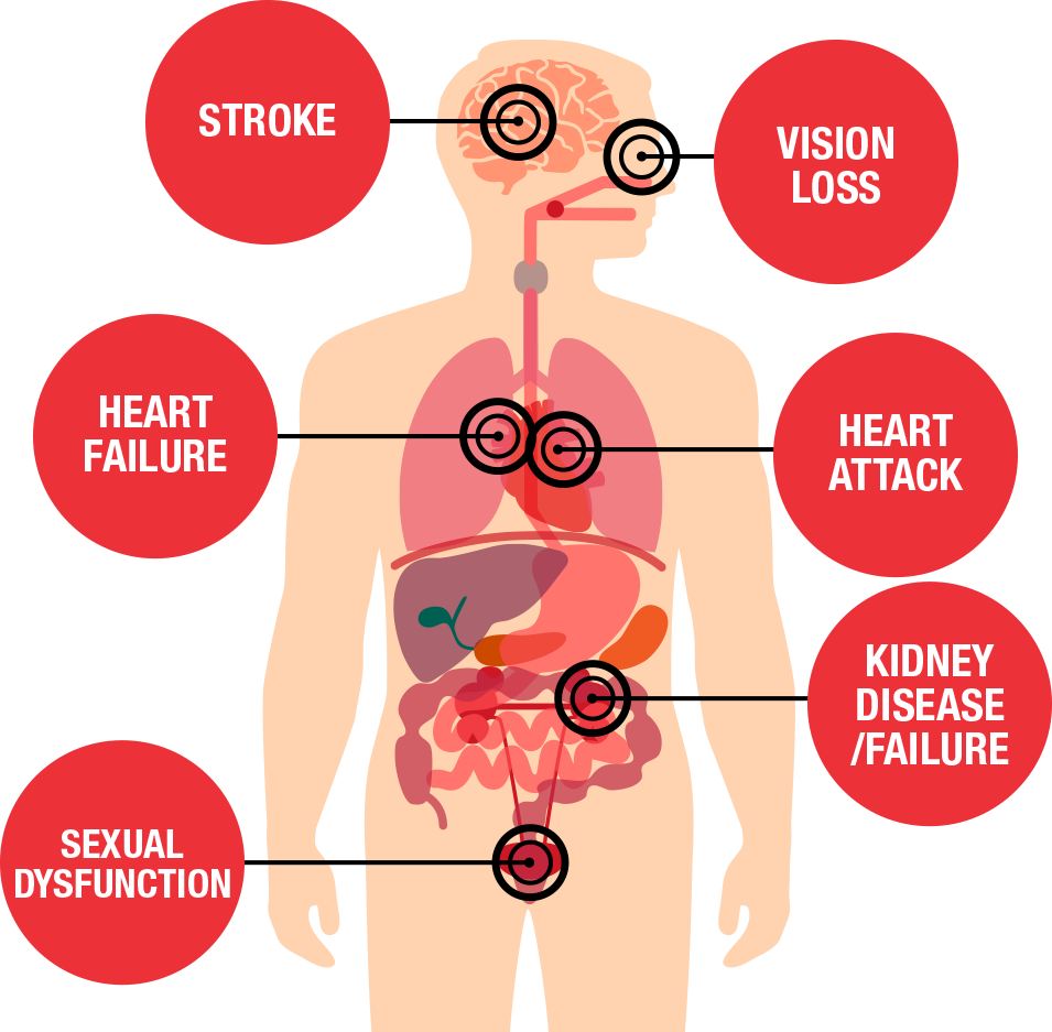 What happens if high blood pressure is not treated?