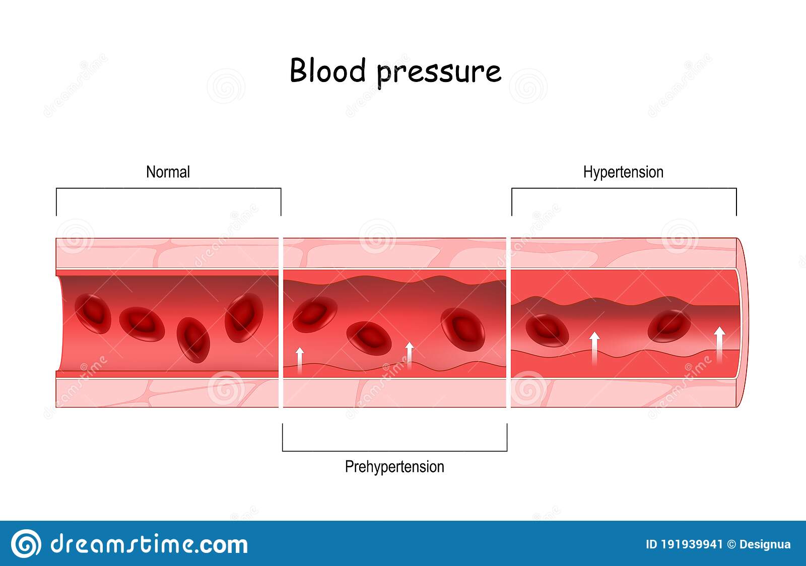 What is the vessel with the highest blood pressure?